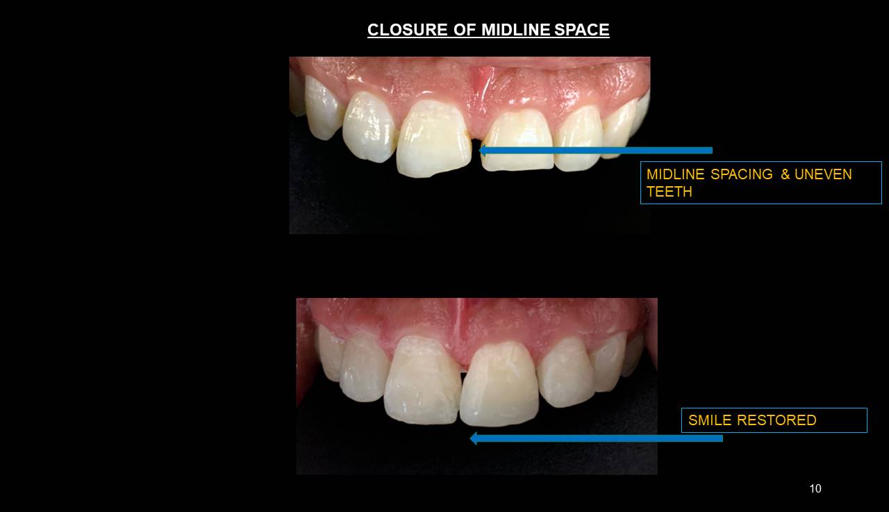 Best dentist Mulund