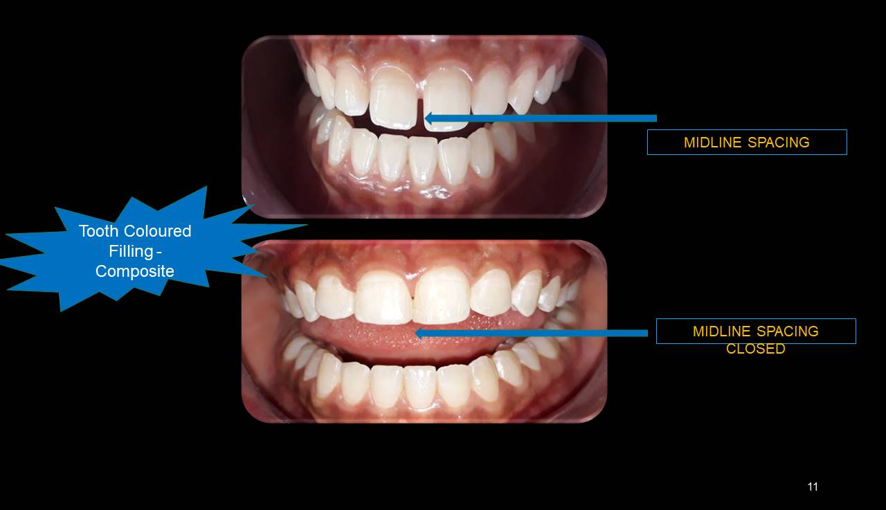 Best dentist Mumbai