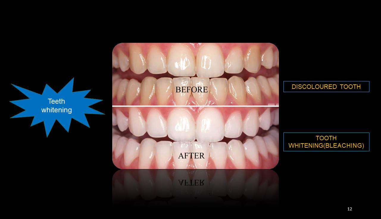 Best dentist Mulund