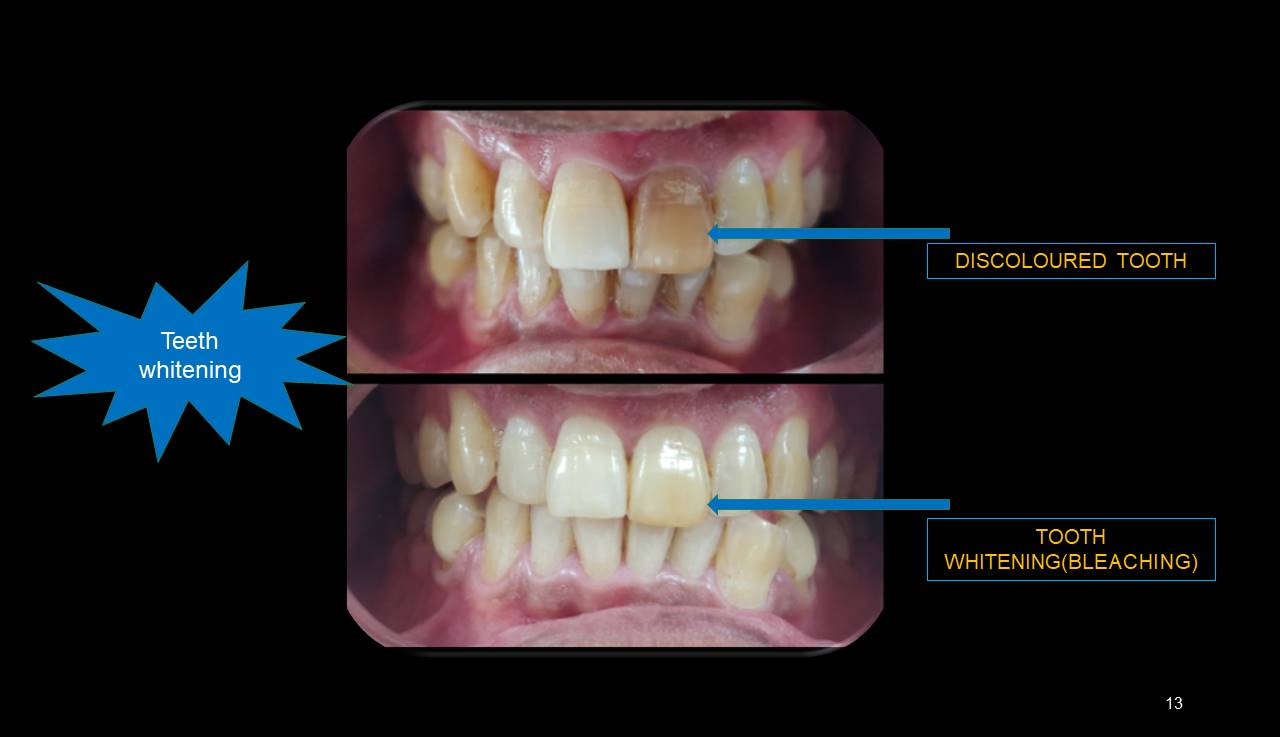 Best dentist Mumbai