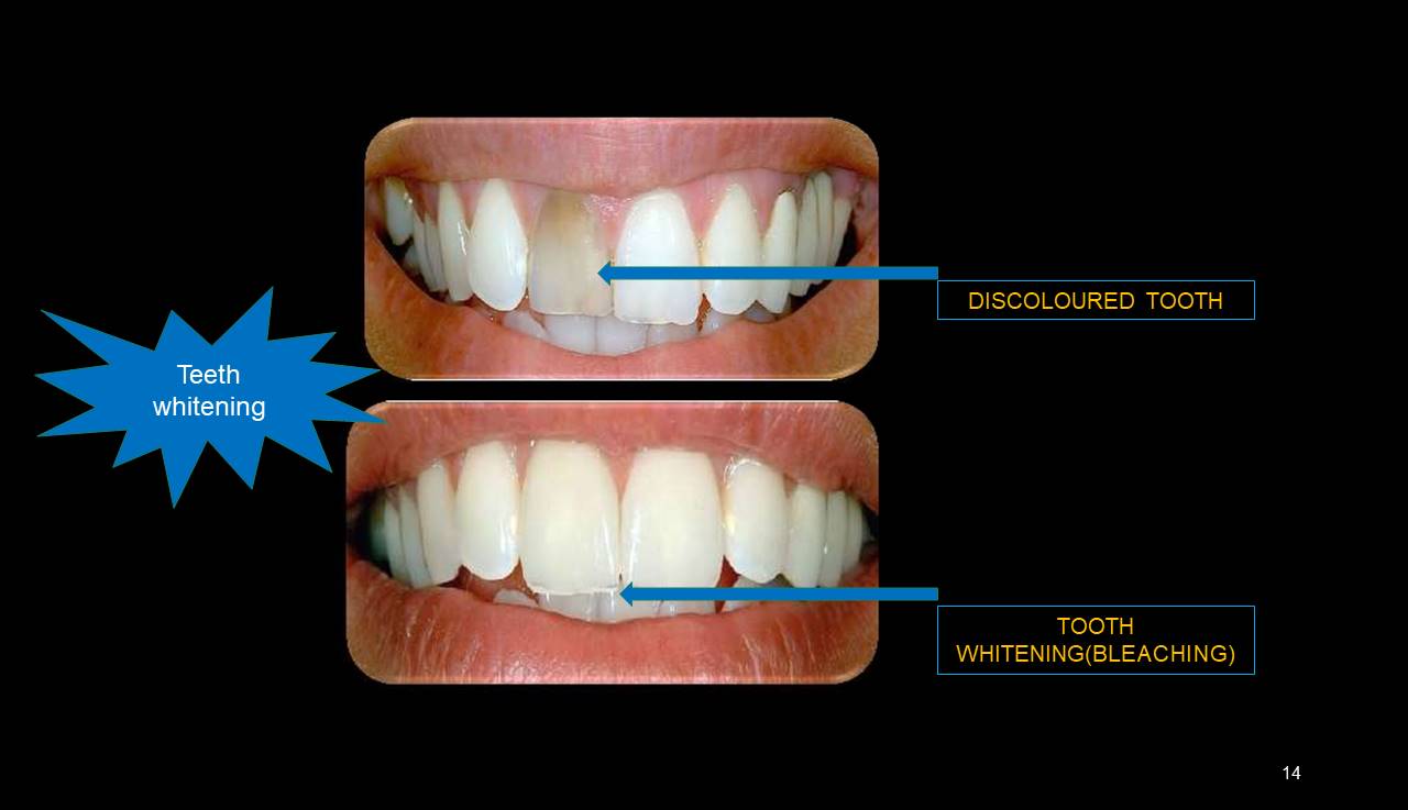 Best dentist Mulund