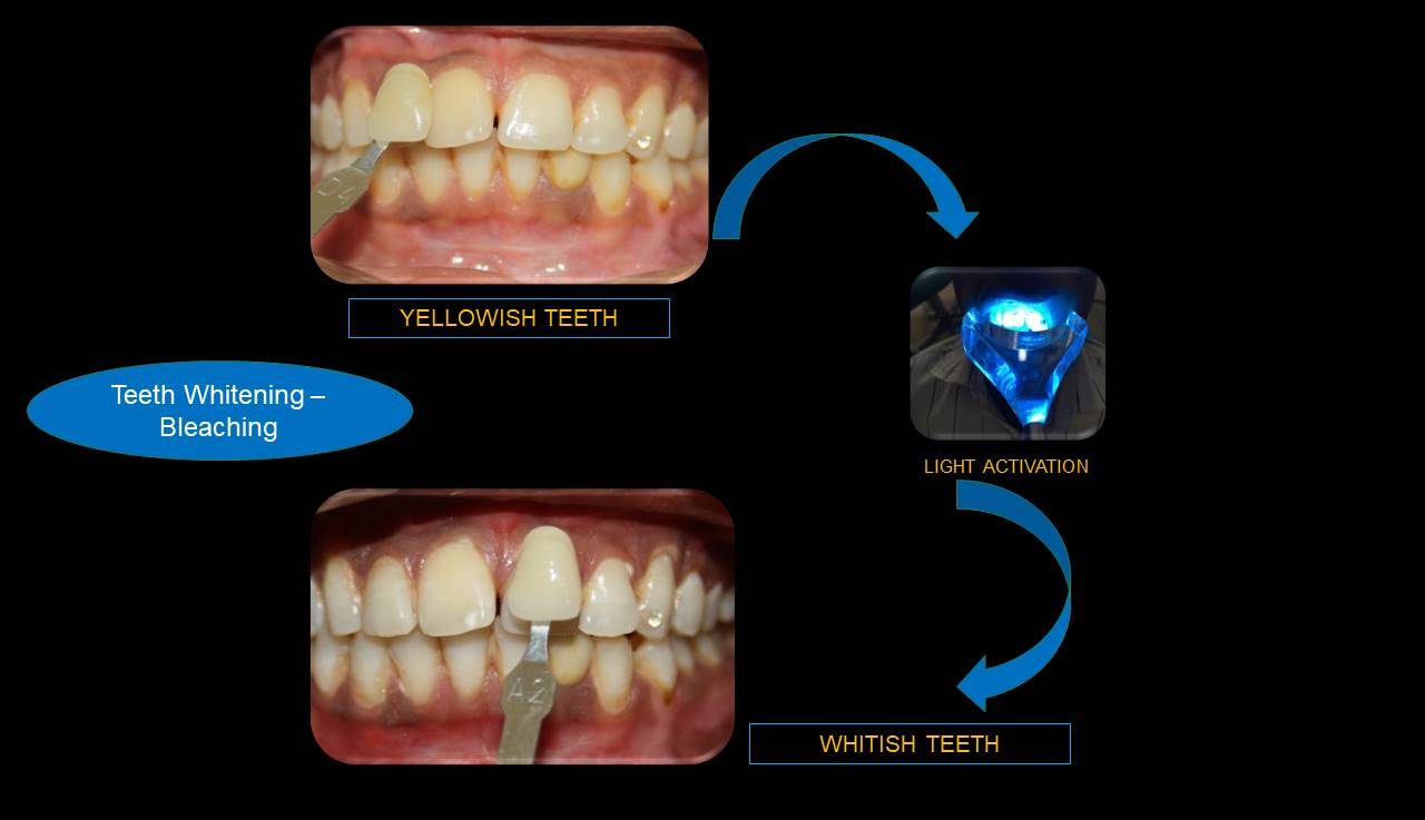 Best dentist Mumbai