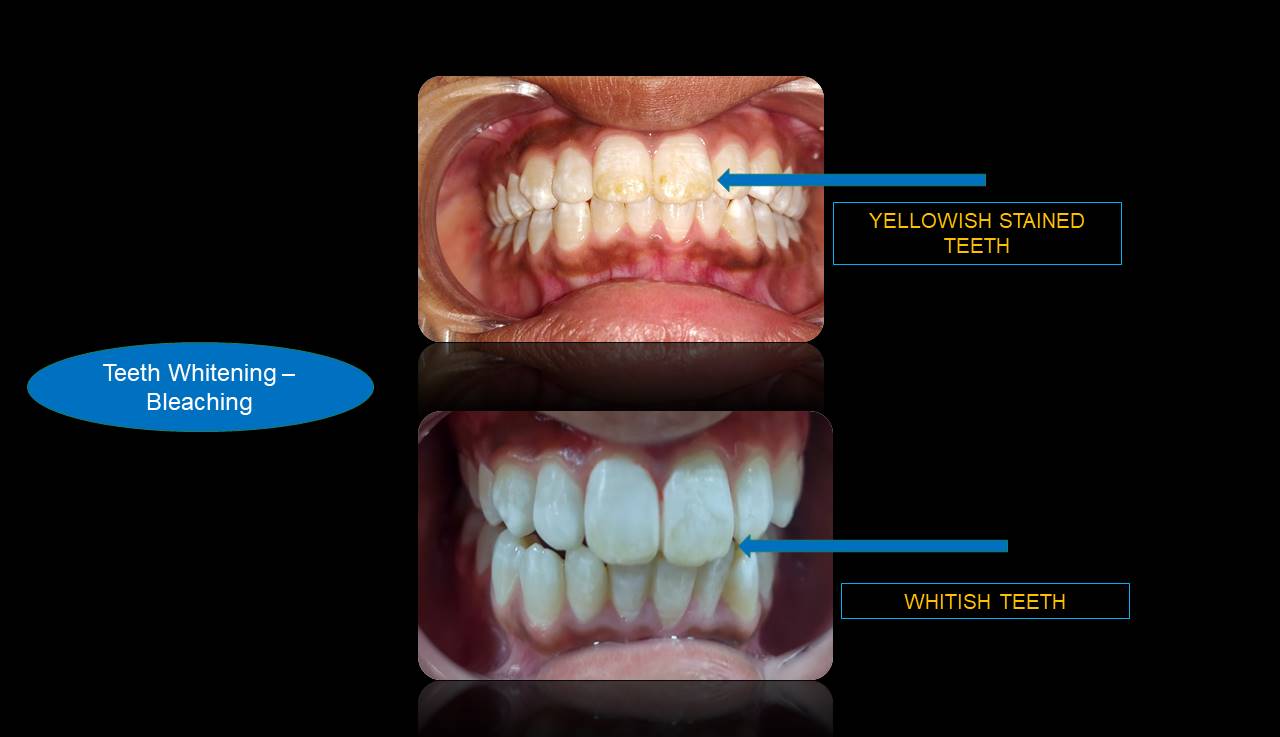 Best dentist Mulund
