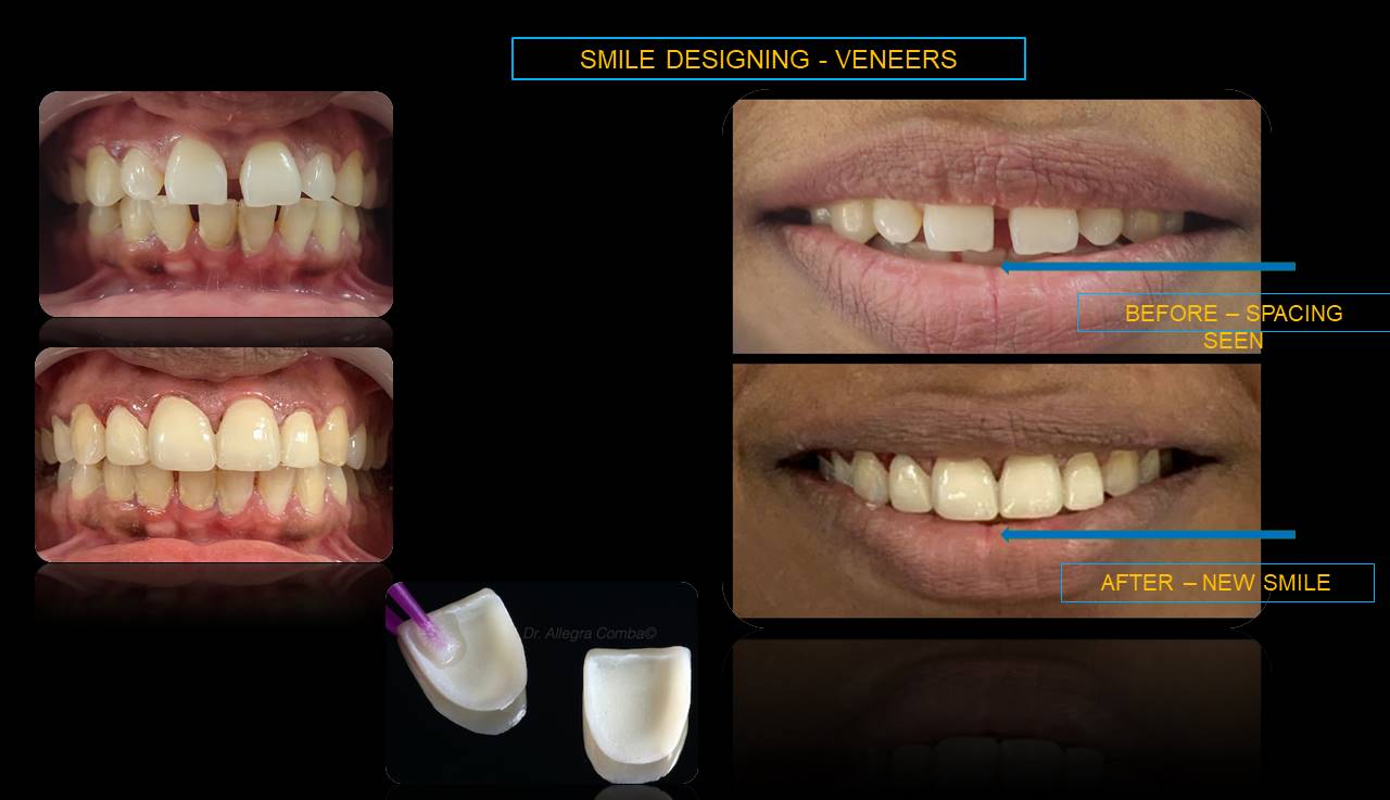Best dentist Mumbai