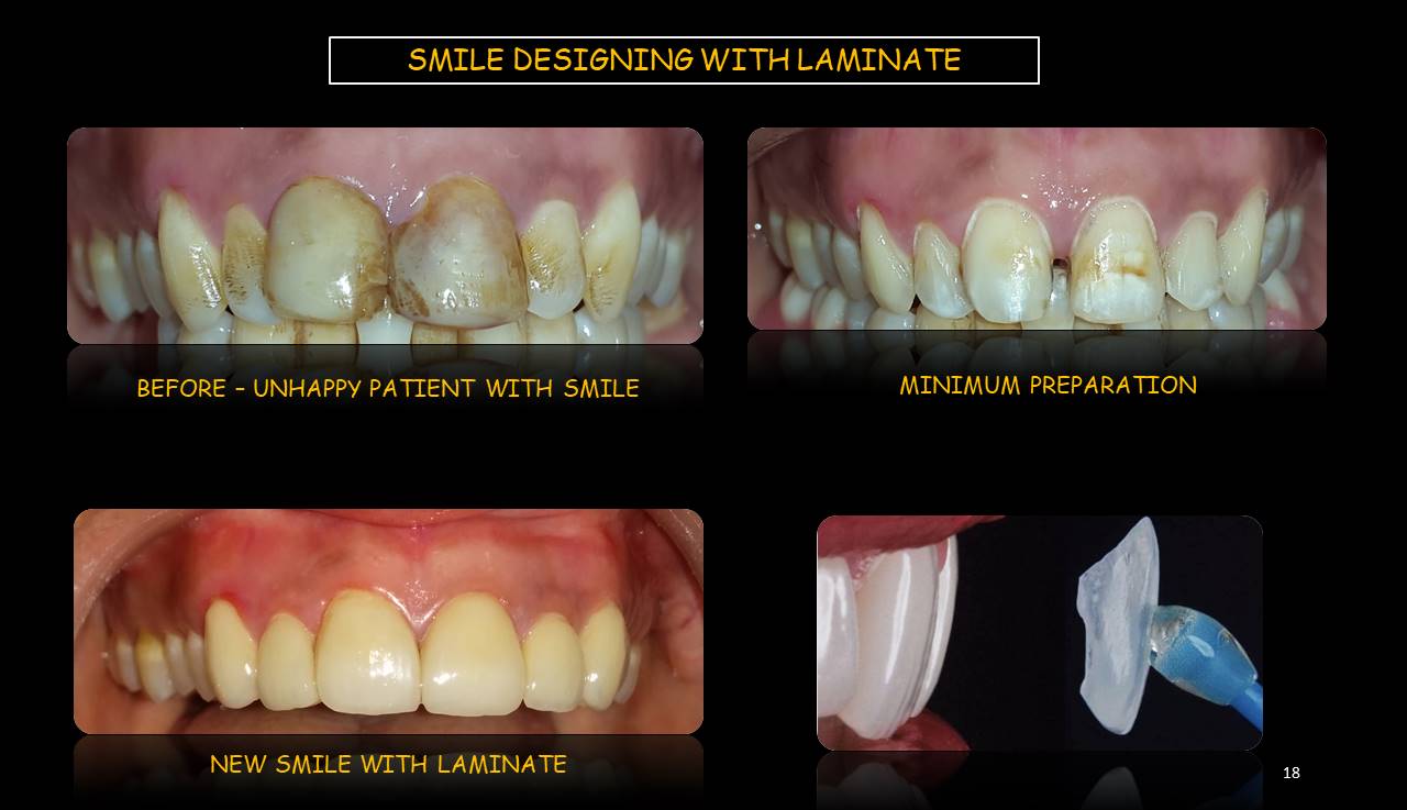 Best dentist Mulund