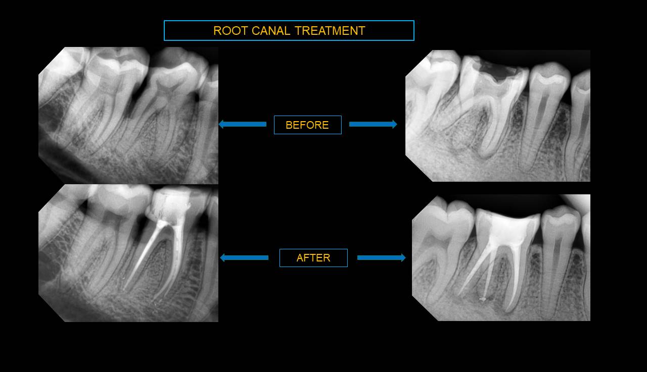 Best dentist Mumbai