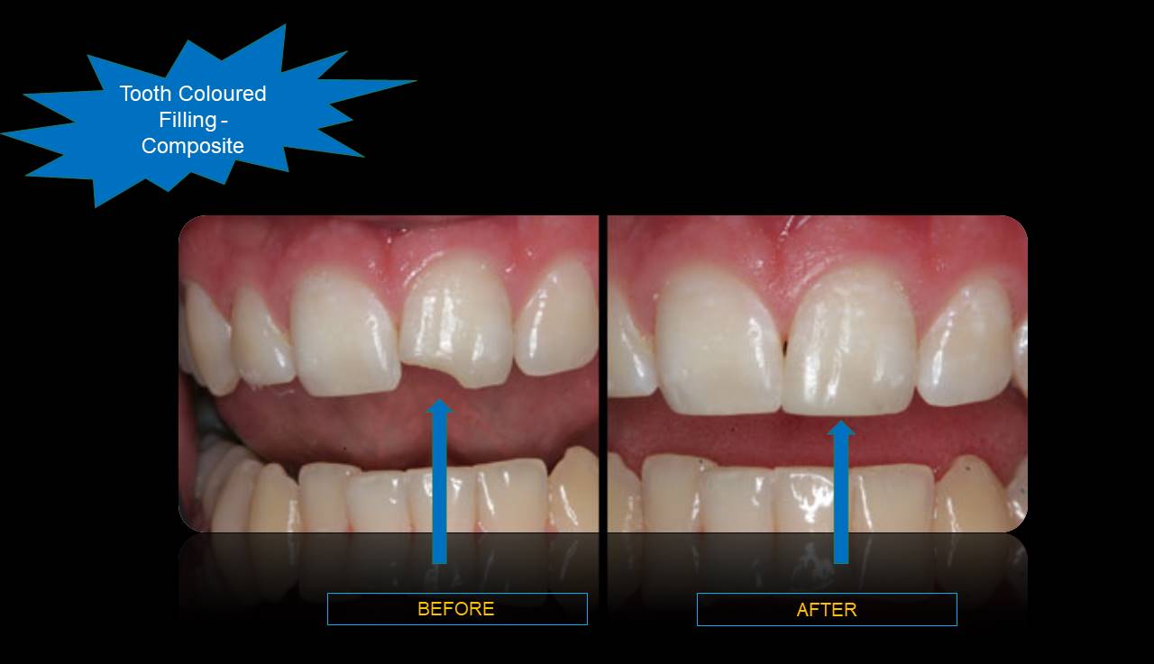 Best dentist Mulund