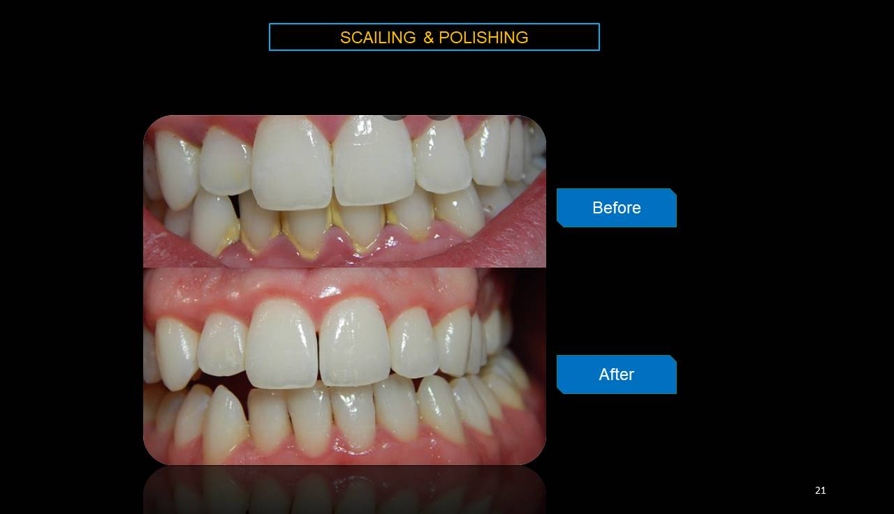 Best dentist Mumbai