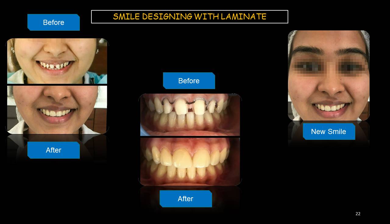 Best dentist Mulund