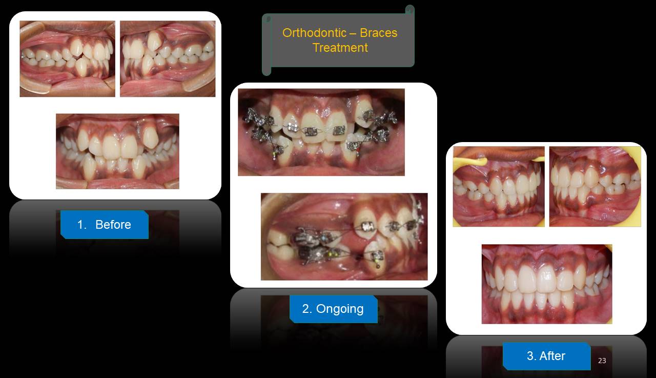 Best dentist Mulund