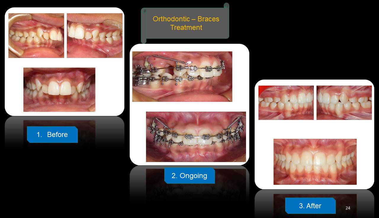 Best dentist Mulund