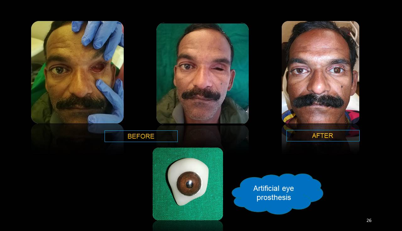 Best dentist Mulund