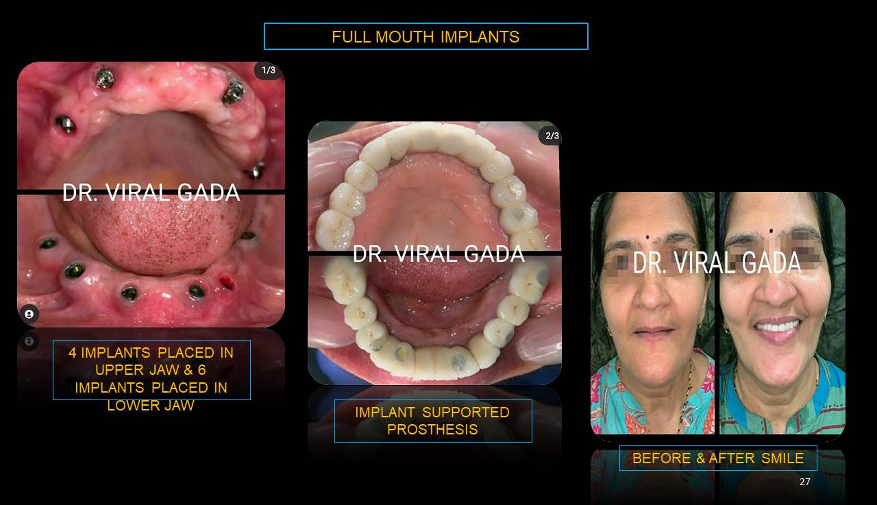 Best dentist Mulund