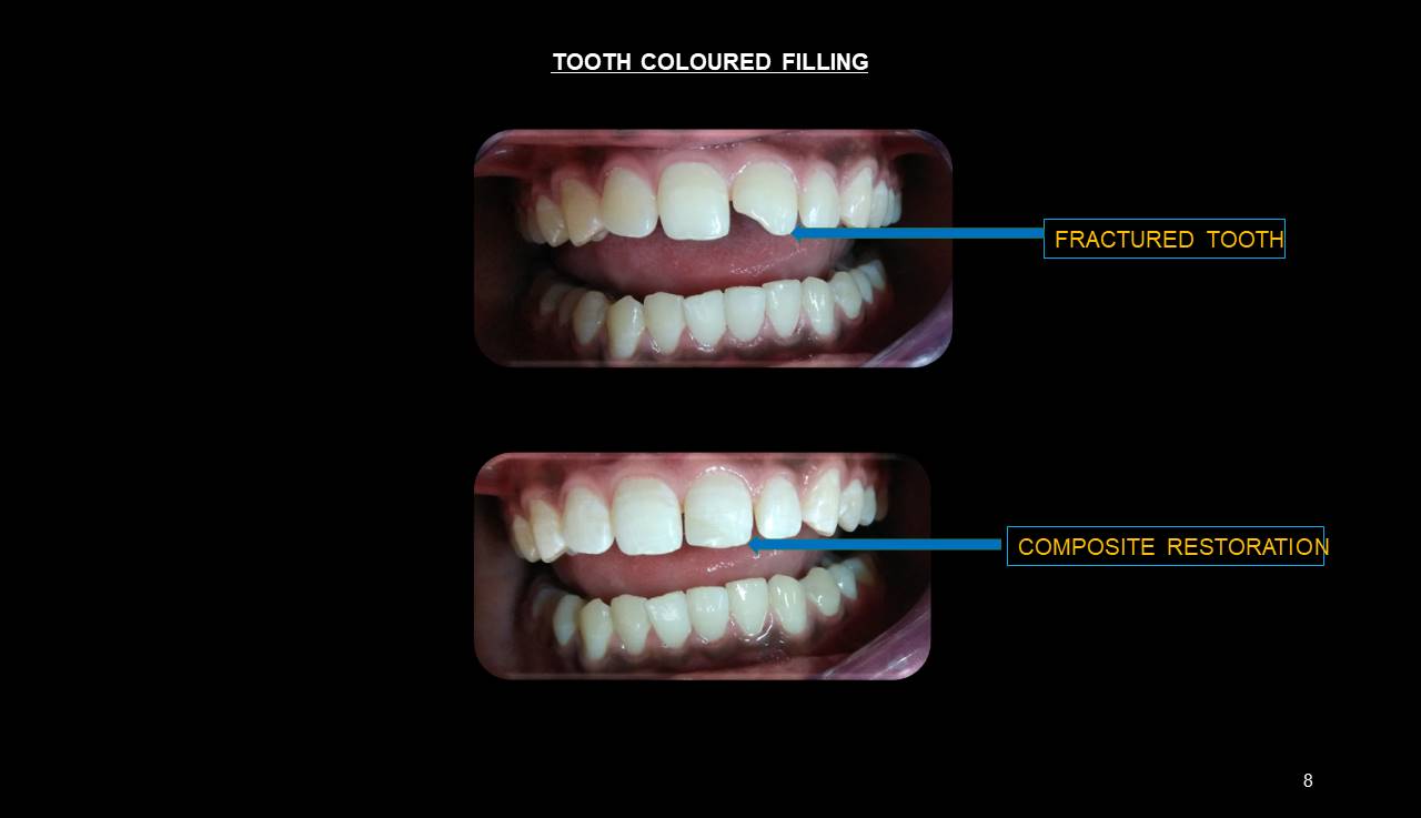 Best dentist Mulund