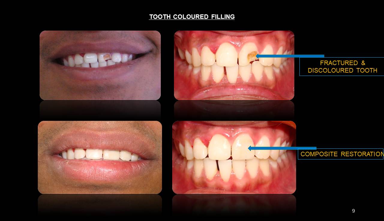 Best dentist Mumbai